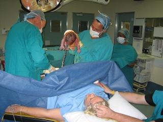 File:Césarienne-Mère-Bébé-Accouchement.jpg