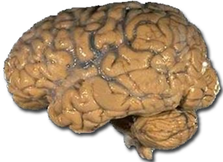 File:Cerveau humain-encephale-encéphale.png
