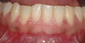 Thumbnail for version as of 11:42, 8 April 2014