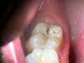 Thumbnail for version as of 19:07, 7 September 2011