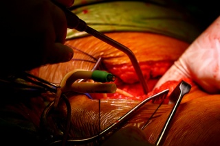 File:Surgical Operative Photography-9077.jpg