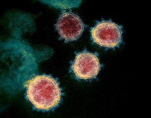 File:Coronavirus SARS-CoV-2.jpg